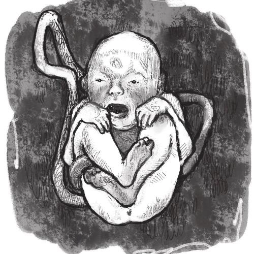 ТВИСТЕД ВИЛ